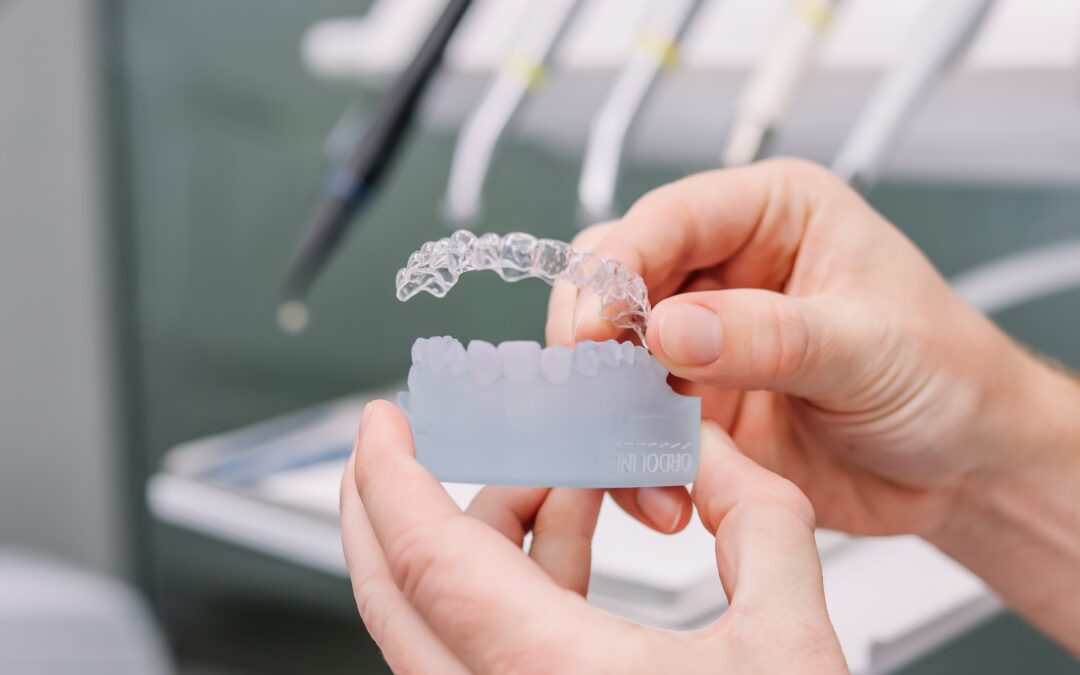 Aligners: de onzichtbare beugel